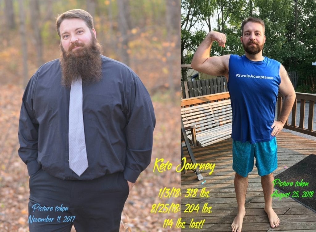 keto weight loss story